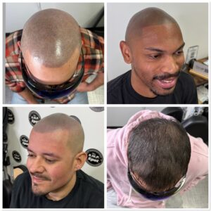 Full SMP Procedure